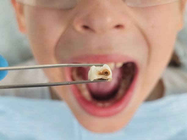 Best Emergency Dentist for Knocked-Out Tooth in Jarrettsville, MD