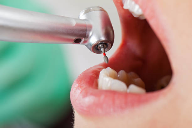 Best Pediatric Emergency Dentist in Jarrettsville, MD